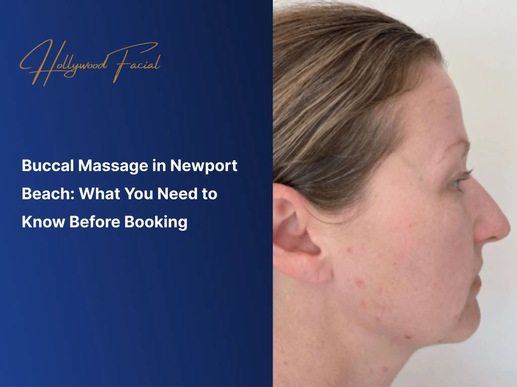 Buccal Massage in Newport Beach: What You Need to Know Before Booking