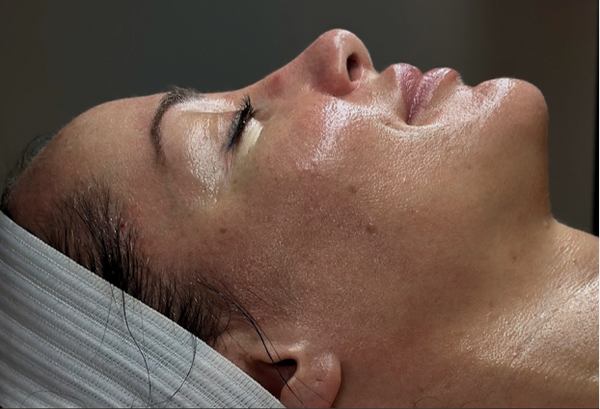 Hollywood Facial Signature