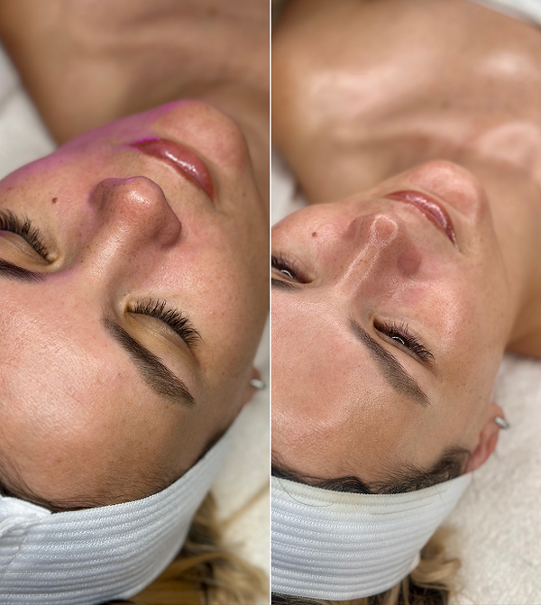 Treatment result