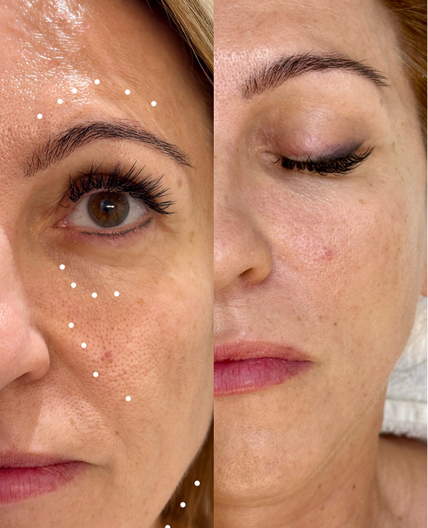 Treatment result