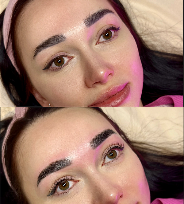 Treatment result