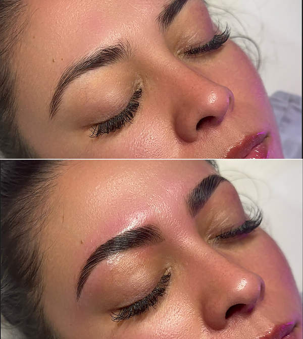 Treatment result
