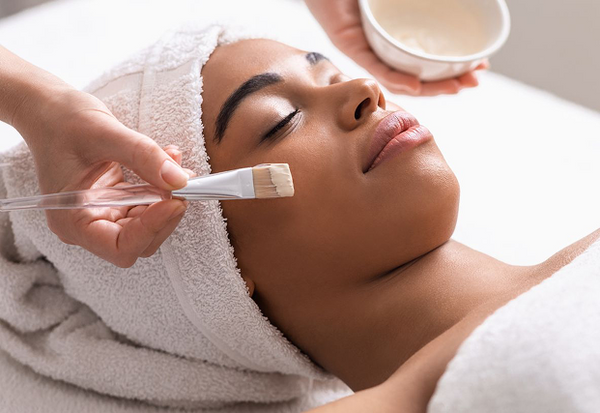 TCA peel - Pigment Lift