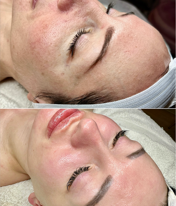 Treatment result
