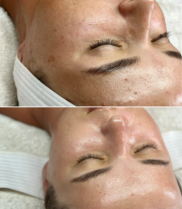 Treatment result