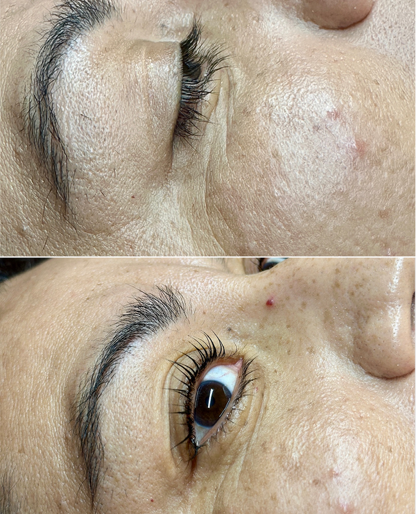 Treatment result
