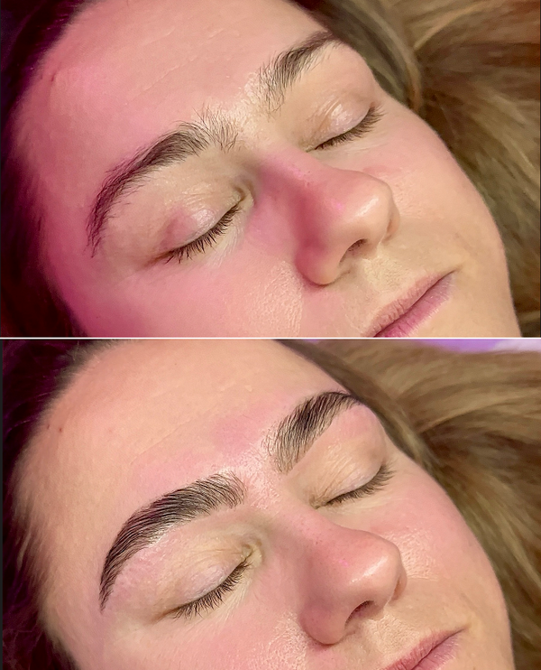 Treatment result