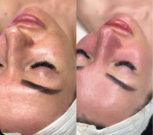Treatment result
