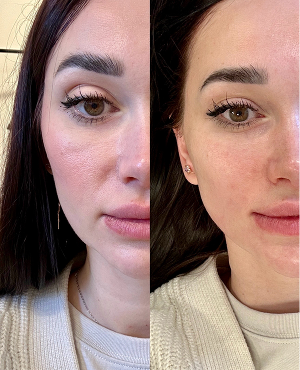 Treatment result